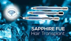 Sapphire FUE Hair Transplant Turkey - Mapa Health