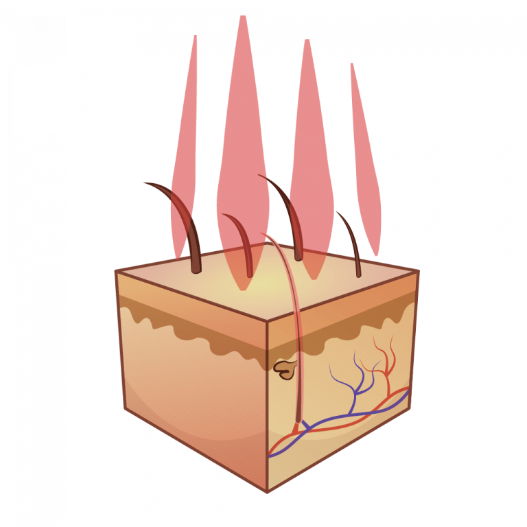 Infographic Haar lazer therapie