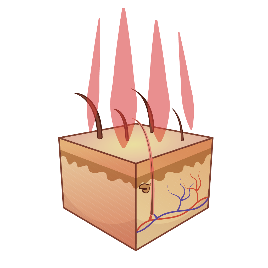 Infographic Haar lazer therapie